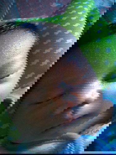 Di kepala kayak ada bekas luka