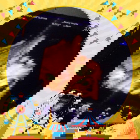 34weekแล้วจ้า