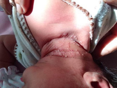 ลูกมีตุ้มตามตัว