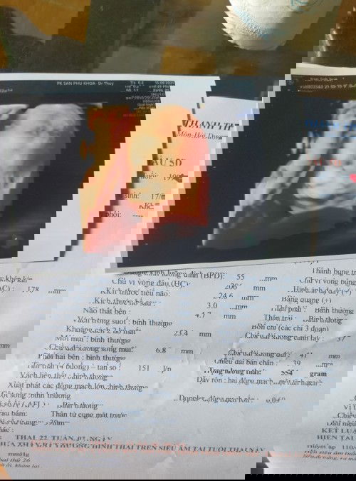 Bé như cái kẹo mà có điệu nằm k giống ai luôn....
Đến bs còn kêu là khó tính nữa cơ...
#boon 22w2d..