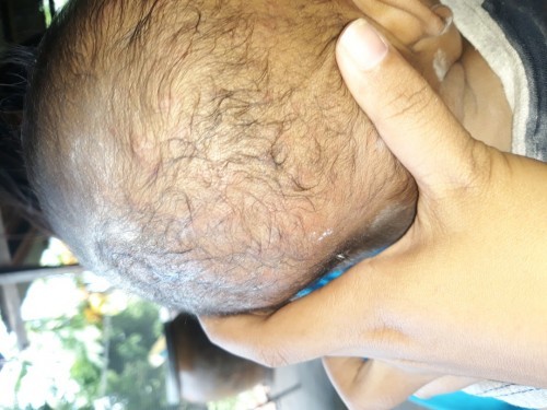 ลูกแพ้อะไรก็ไม่รู้คะควรทำยังไงดีคะมีตุ่มขึ้น แล้วน้องก็ น้องก็เกาด้วยค่ะ