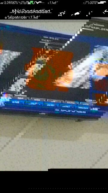 HASIL USG MATA JANIN