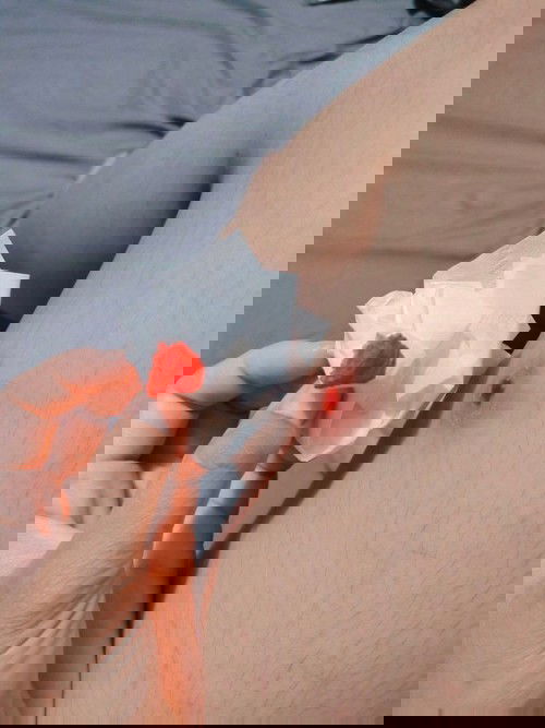 เป็นแผลไม่หายสักที