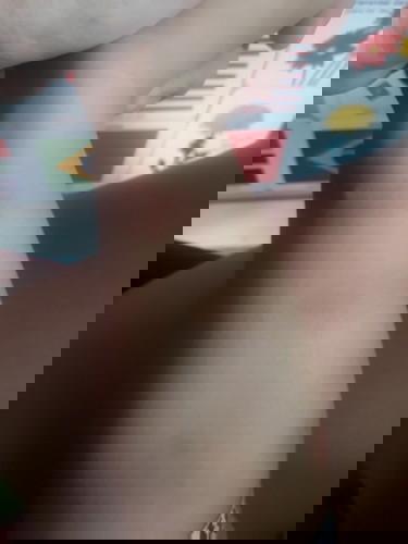 Mấy chị ơi có cách nào hay thuốc nào trị thâm do muỗi trích cho bé không ạ chỉ e với ạ ..