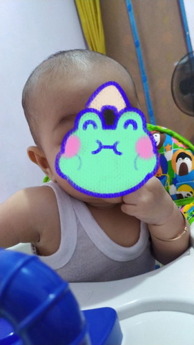 Rekomendasi obat penumbuh rambut bayi tercepat