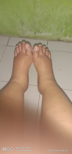 Kaki bengkak saat hamil tua, cara mengatasi nya