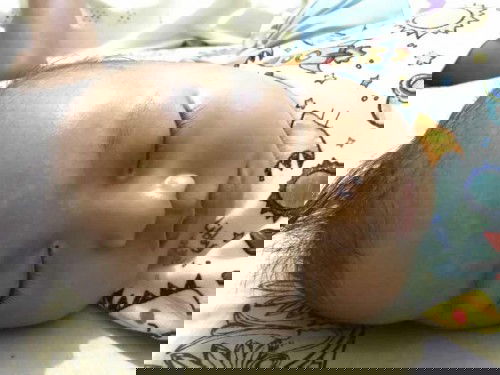 Putih2 di jidat kaya panu