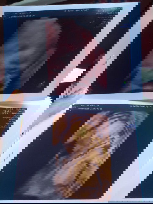 Mau tanya nih bun...