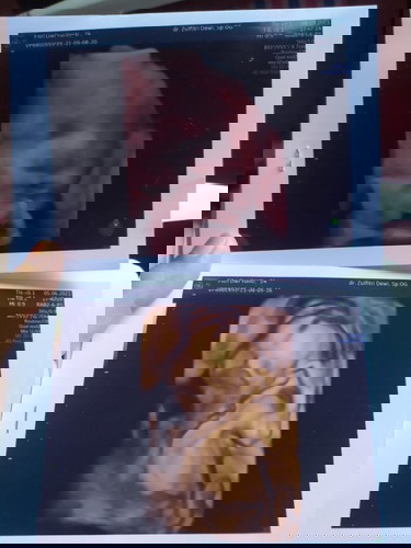 Mau tanya nih bun...