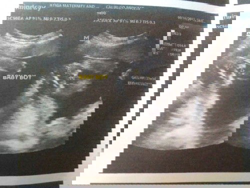 My baby boy👶💞23 weeks preggy