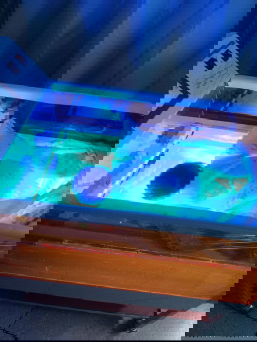 ลูกอายุ9วัน กลับมา ตรวจhct,MB  MB=19.7สูงมากต้องส่องไฟดื่มนมแม่อย่างเดียว