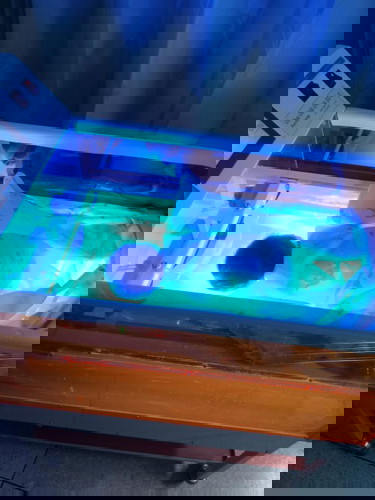 ลูกอายุ9วัน กลับมา ตรวจhct,MB MB=19.7สูงมากต้องส่องไฟดื่มนมแม่อย่างเดียว