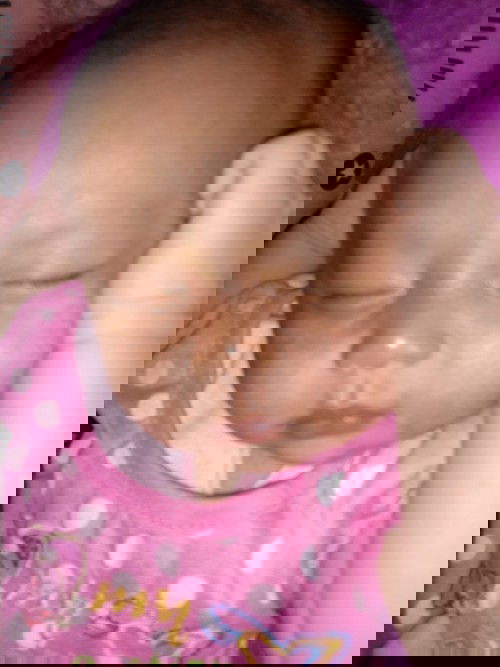 Kmrn biang keringat tp udh mendngan trus skrng kulit nya jdi gak rata karna kulit ny mengelupas