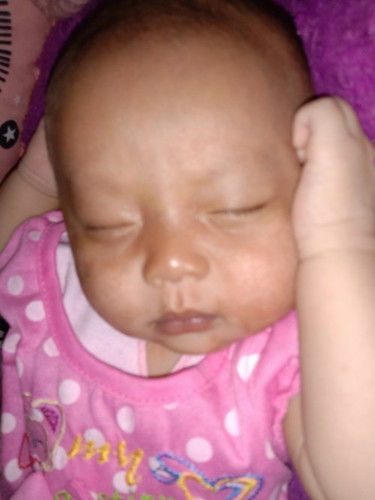 Kmrn biang keringat tp udh mendngan trus skrng kulit nya jdi gak rata karna kulit ny mengelupas