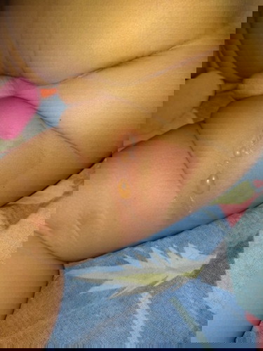 โดนหม้อหุงข้าว