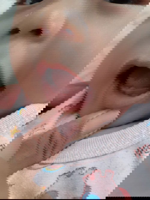 ฟันลูกกำลังงอก