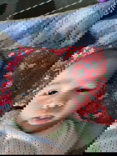 Ada tak sama mata dengan anak saya..umur 3 bulan 6 hari.mata sepet sebelah