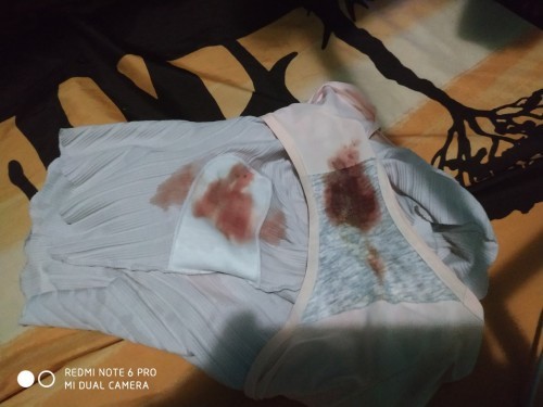 Spotting third trimester