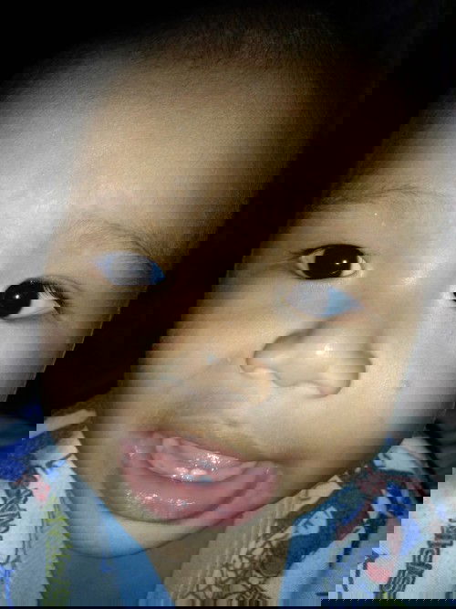 จะหายป่าวค่ะ  ขอคำปรึกษาหน่อยค่ะ  น้องแม่ๆคนไหนอลนเปนไม่ค่ะ