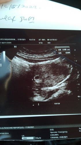 Salam sya nak tanya sya pregnant dalam 5 minggu..bila sya pergi Scan nmpak kantung saja. Normal ke..