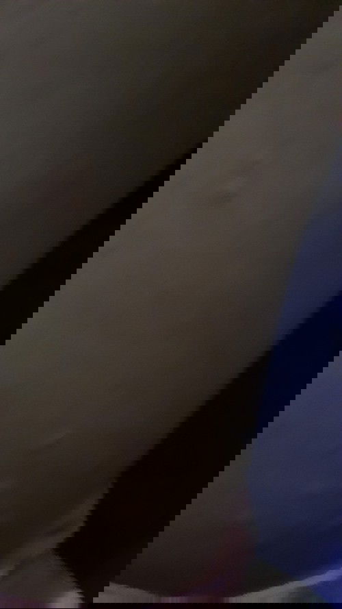 E sanh đươc 15ngay la da e bi ngưa nhu vay khăp nguoi moi nguoi chi e voi.