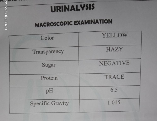 URINALYSIS RESULT