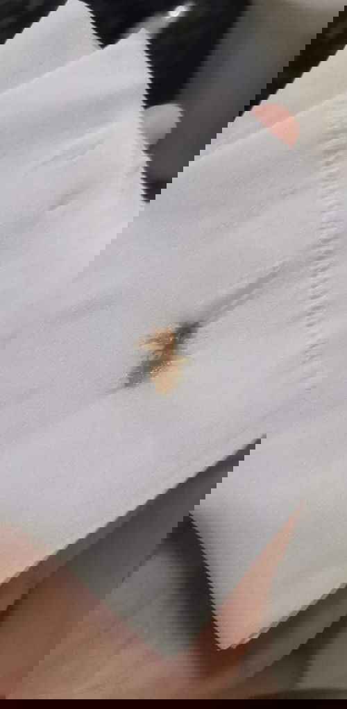 มูกเลือดมูกน้ำตาล