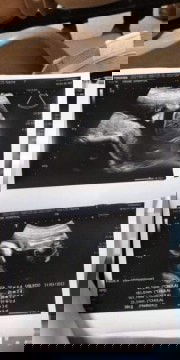 ทั้งที่ทำงานมีเเต่คนทักว่าน้องน่าจะหญิง แต่ที่จริงเเล้วไม่หญิงน่ะจ้า หมอว่าดูดีๆคับเเม่ ขำตาไหลเลย😅