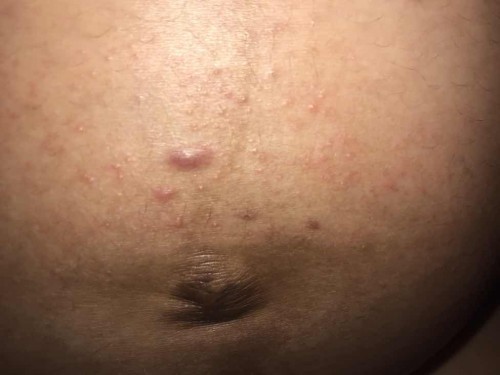 สอบถามแม่ๆคะ