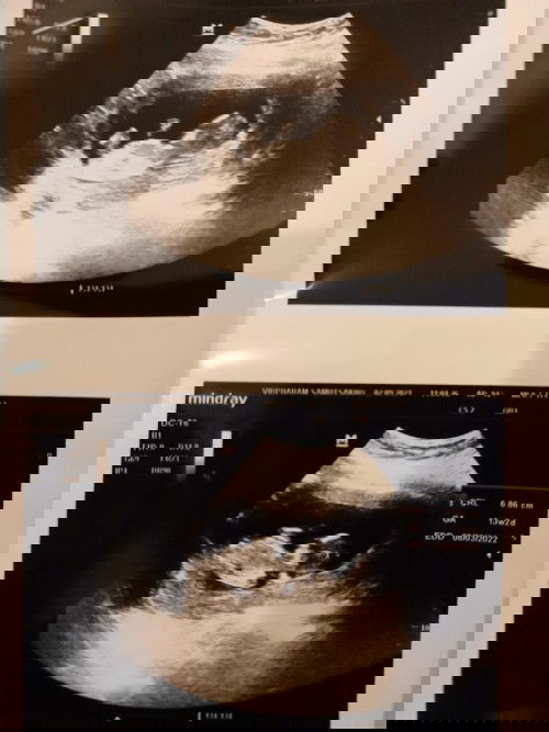 คุณเเม่บ้านนี้นั่งทำงานค่ะ
นั่งตัดชิ้นงาน
อยากได้ที่นั่งเเบบเพื่อสุขภาพของเเเม่