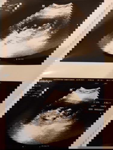 คุณเเม่บ้านนี้นั่งทำงานค่ะ
นั่งตัดชิ้นงาน
อยากได้ที่นั่งเเบบเพื่อสุขภาพของเเเม่