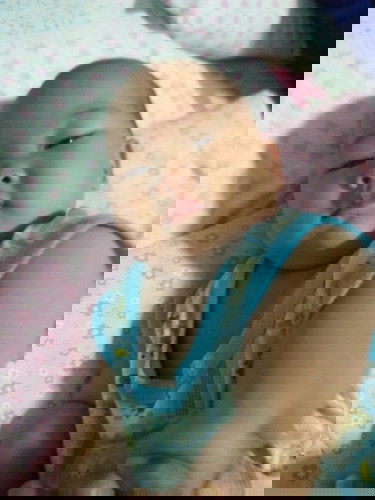 อยากทราบว่าโรคมือเท้าปากในเด็กนานแค่ไหนถึงจะหายคะตอนนี้น้องเป็นมา2/อาทิตย์กว่าแล้วคะตุ่มก้อยังขึ้น