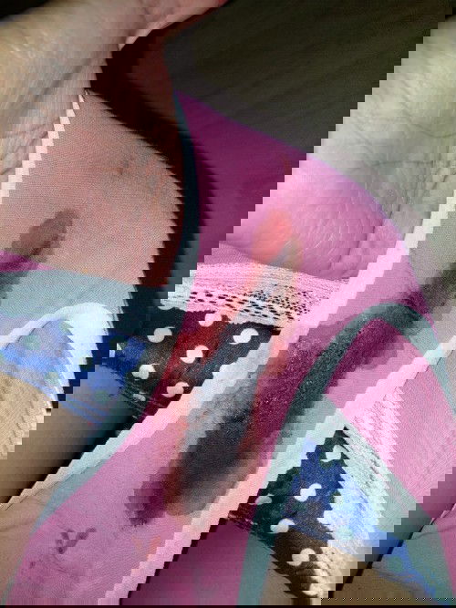 Not sure if abnormal menstruation