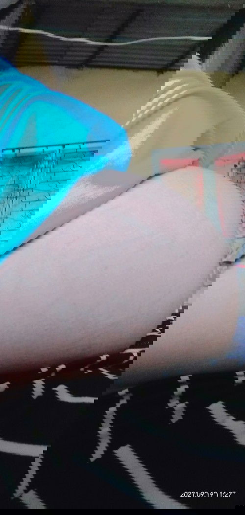 Mag 8mons na po ngayong sept.Duedate ko po nov,3Cesarean .sabi po nila malaki na tiyan ko .