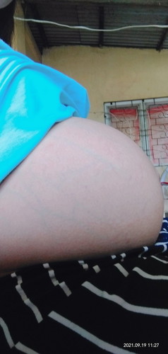 Mag 8mons na po ngayong sept.Duedate ko po nov,3Cesarean .sabi po nila malaki na tiyan ko .