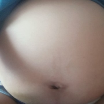 สอบถามแม่ๆหน่อยคะ ท้องแบบนี้ ช/ญคะ ตอนนี้37+1แล้วคะ เริ่มปวดหลังร้าวลงจิมิ จะลุกจะนั่งจะเดินก็ลำบาก