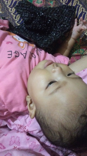 Bayi sering terbentur