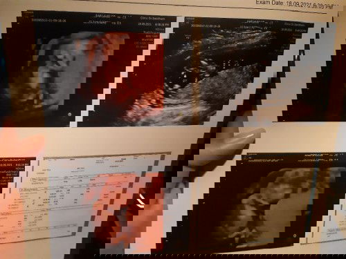 16+1ท้องแรก