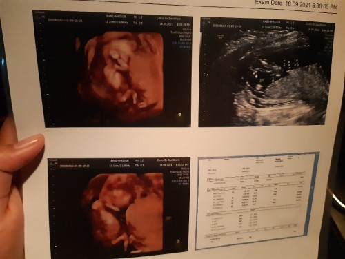 16+1ท้องแรก