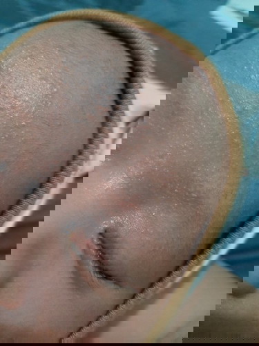 Kenapa kulit anak ku?