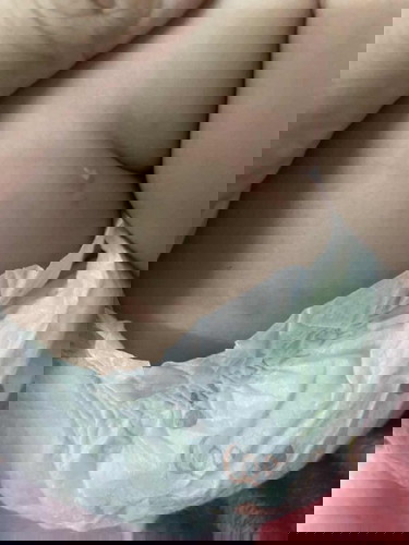Con e bị nổi như vầy là bị gì vậy ak?
