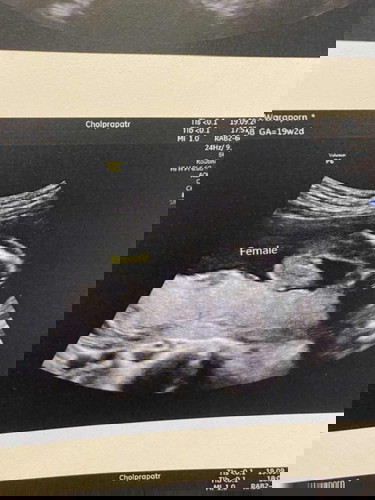 คุณหมอบอกว่า ผู้หญิง น้องผู้หญิงจริงๆใช่ไหมคะ5555