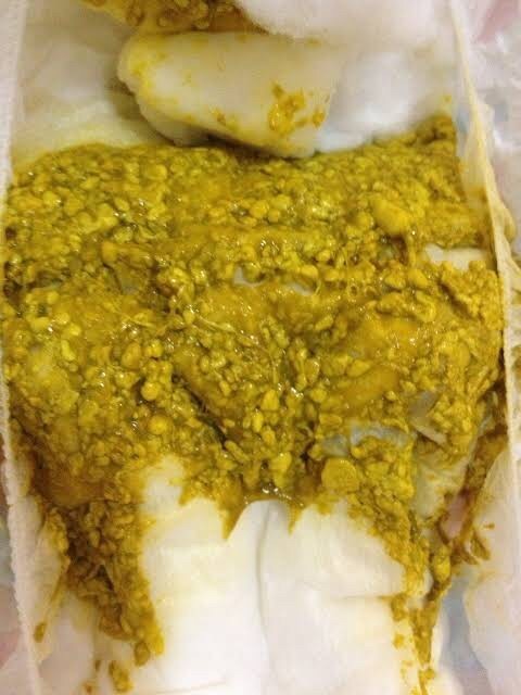 ถ่ายทารกแรกเกิด แบบนี้ปกติไหม