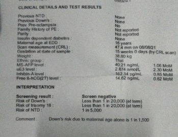 แม่ๆคนไหนหมอนัดไปตรวจดาวน์ซินโดรมบ้างคะ