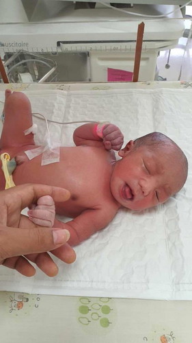 อัณฑะยังลงไม่ครบ