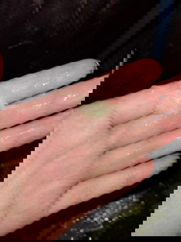 บางทีก็สงสัยว่าคือตกขาวหรือมูกใส