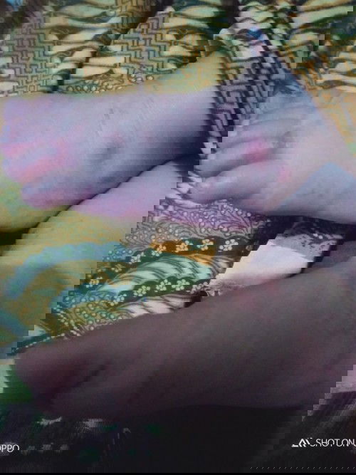 Mau tanya apakah ini alergi susu sapi ya , gatal² bintik merah d tangan kaki badan ..