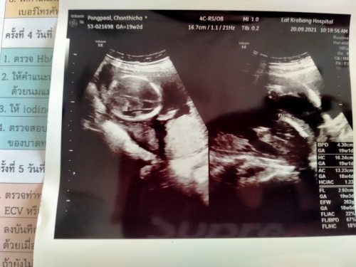 ช่วยดูหน่อยค่ะ