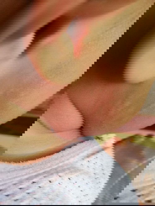 Sejenis ruam ker..???