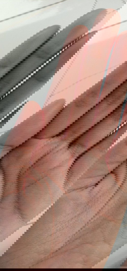 Nyeri tangan dan jari